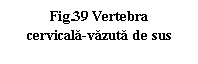 Text Box: .39 Vertebra
cervicala-vazuta de sus
