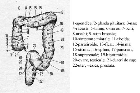 Colonul.jpg (29858 bytes)